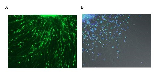 Representative 
images of alpha-synuclein localization in control neurons
Pictured are images of cultured control neurons that were differentiated from iPS cells 
derived from skin biopsies of unaffected donors